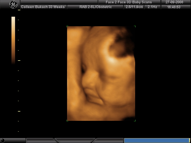 We had some 3D ultrasound