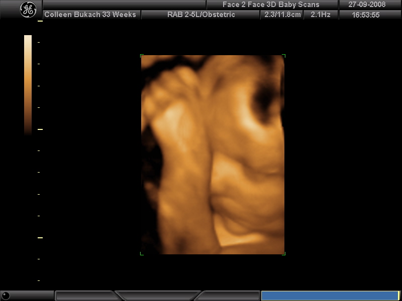 3d ultrasound pictures at 20 weeks. We had some 3D ultrasound